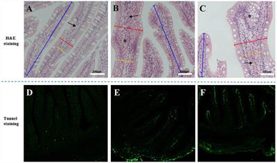 PRR-Mediated Immune Response and Intestinal Flora Profile in Soybean Meal-Induced Enteritis of Pearl Gentian Groupers, Epinephelus fuscoguttatus♀ × Epinephelus lanceolatus♂